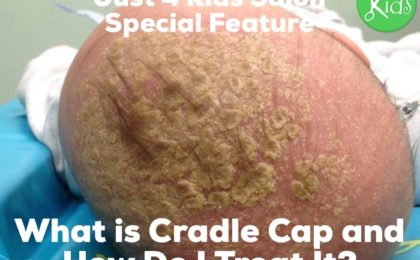 What is Cradle Cap and How Do I Treat It with Pure Coconut Oil